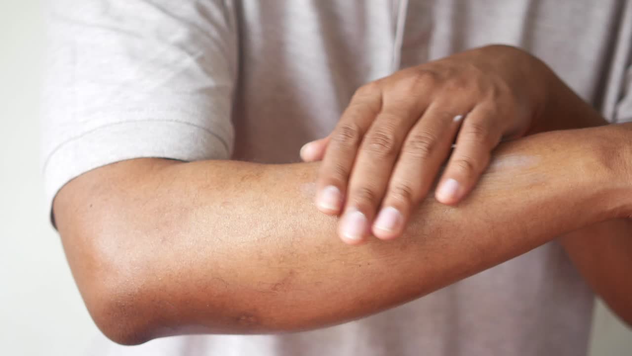 la aplicación de loción en el brazo