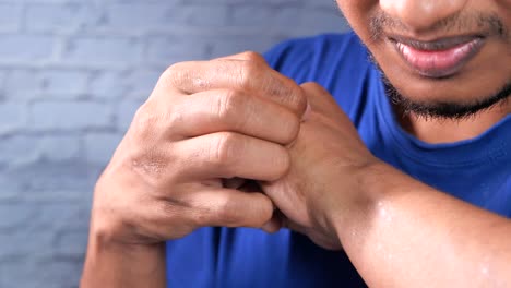 man scratching his wrist