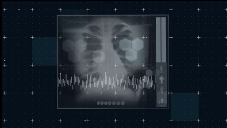 animation of black digital screen with x ray photo and graphs