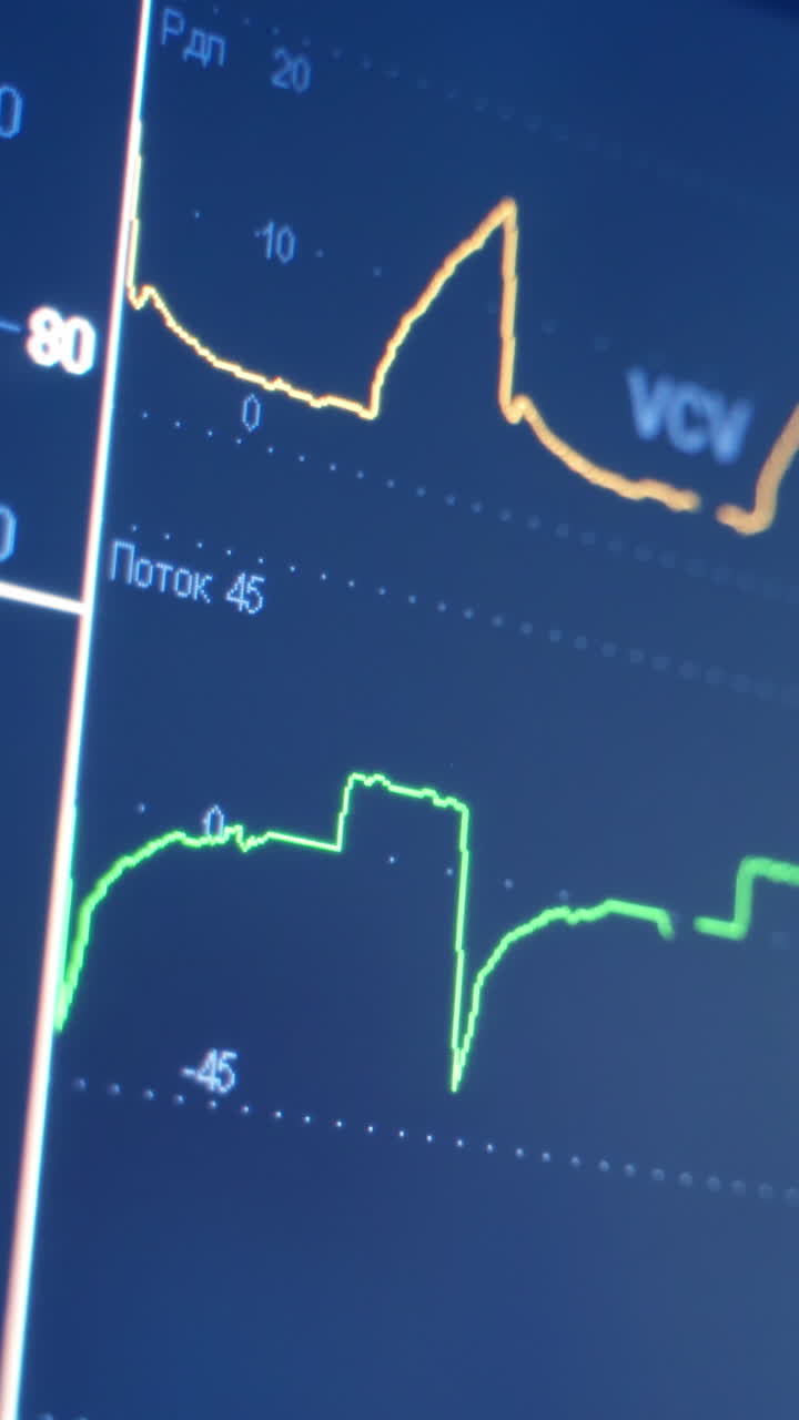 Monitoring vital signs of the patient as heart rate. Digital heart monitor read out with lines graphing and numbers displayed of patient being measured. Close-up. Vertical video