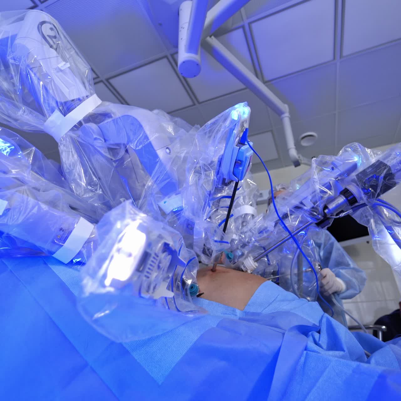 Modern surgical system. Medical robot. Minimally invasive robotic surgery