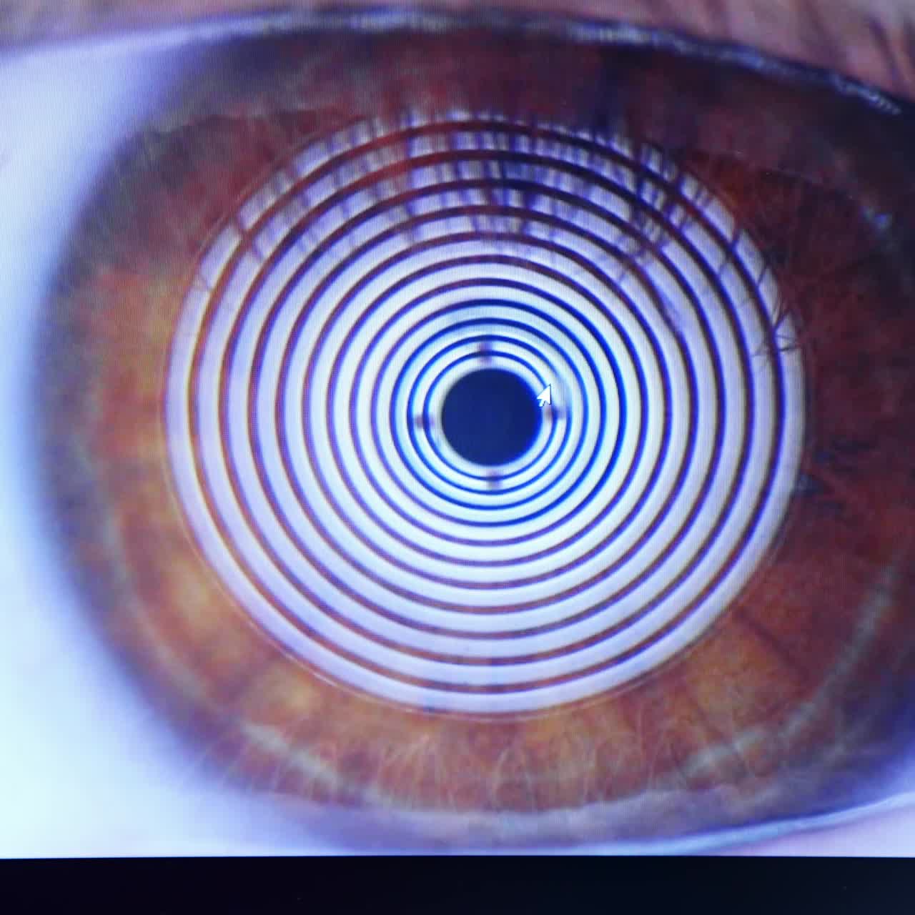 Eye of a patient on screen. Enlarged eyeball on a professional ophthalmology equipment. Close-up