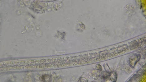 Roundworms-nematodes,-Steinernema,-under-the-microscope-at-600-times-magnification-with-view-on-the-digestive-tract