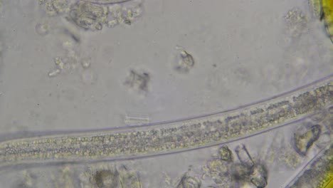 gusanos redondos, nematodos, steinernema, bajo el microscopio con un agrandamiento de 600 veces con vista en el tracto digestivo