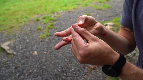 man in nature cut his little finger and is squeezing his wound in front of camera while blood is pouring out over his hands - close up of hands and wound with no face