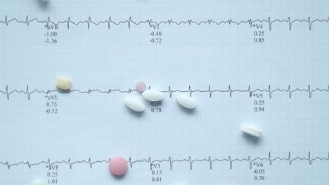 ecg with medications