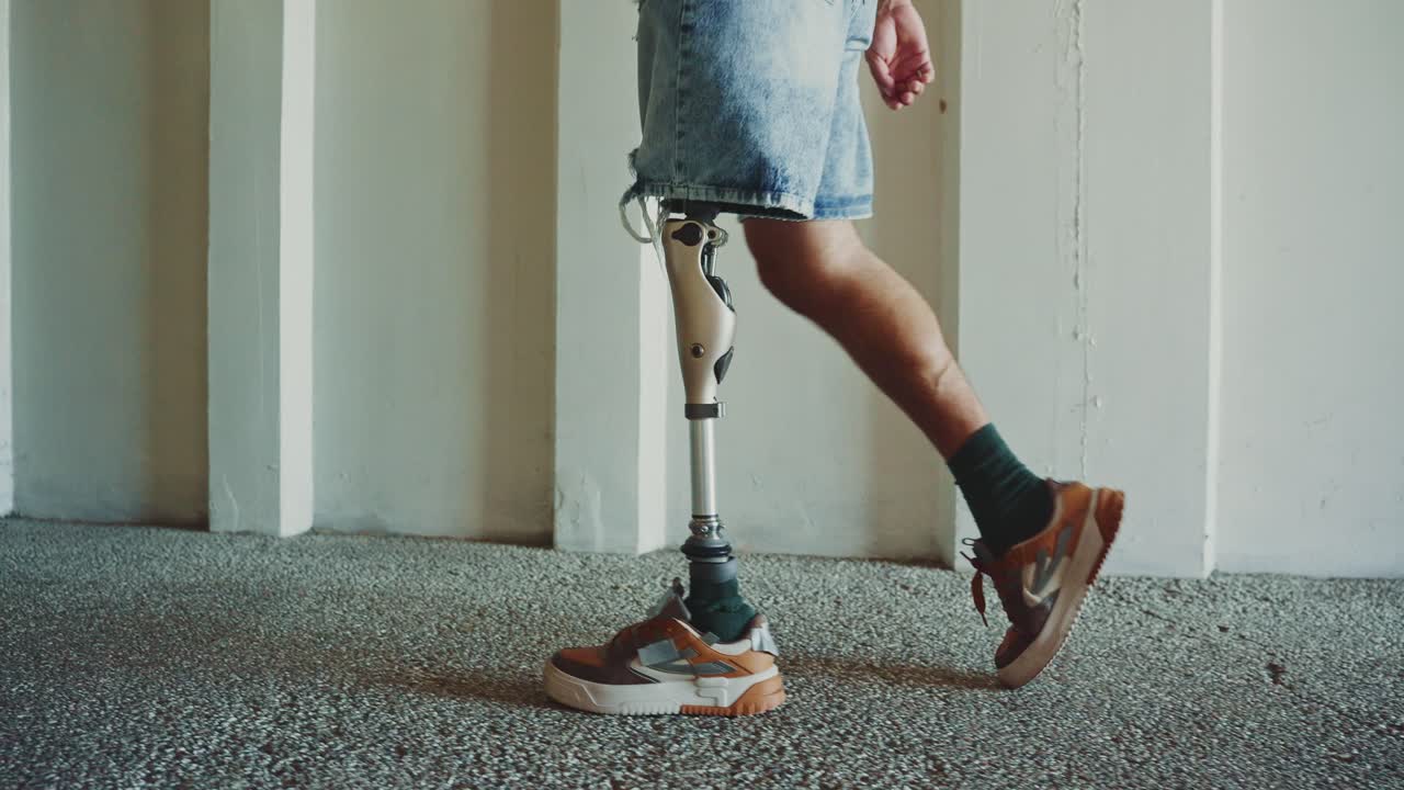 Man with Prosthetic Leg Walking