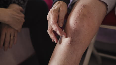 knee surgery scar