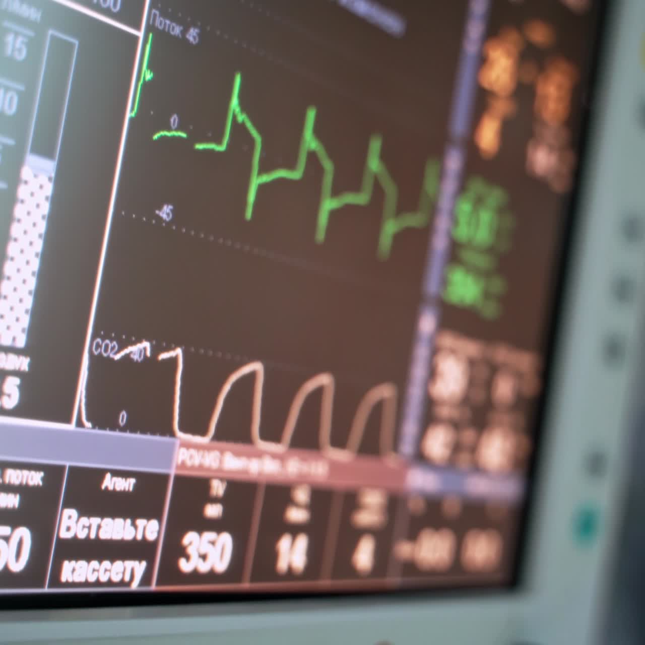 Monitor in the operating room. Diagrams of vital patient's signs on the screen of monitor on the blur background of surgical process. Close-up.