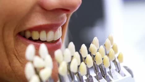 Dentist-holding-teeth-shades-against-female-patient