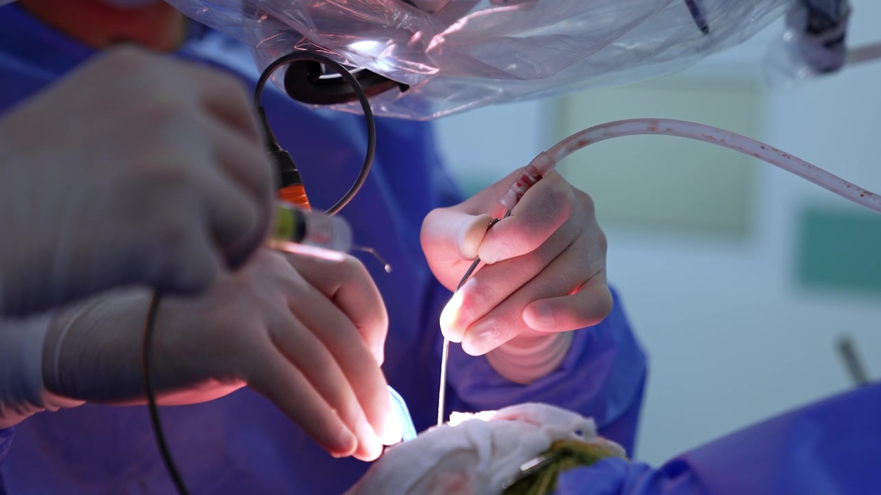 Two pairs of hands in latex gloves work at neurosurgery. Close up. Surgeon holds the tools and assistant uses a syringe.