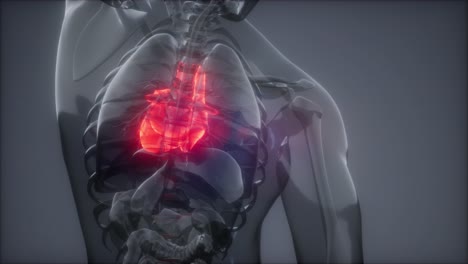 exame de radiologia do coração humano