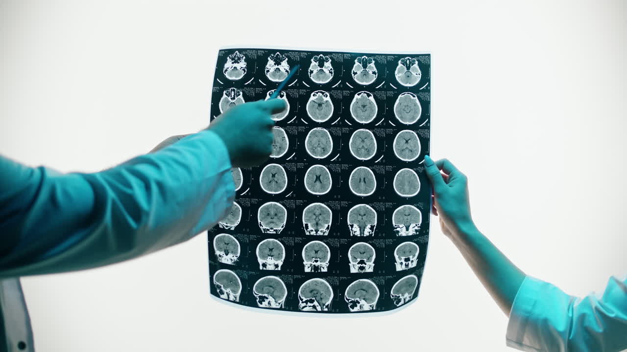Professionisti medici che esaminano una scansione cerebrale umana per diagnosi