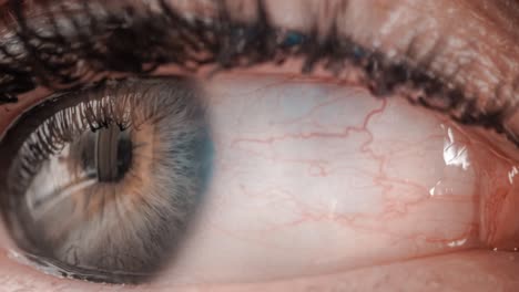 mujer con un solo ojo de cerca