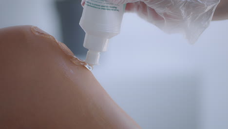 apply a conductor gel to the legs for laser hair removal. preparation of legs before laser hair removal