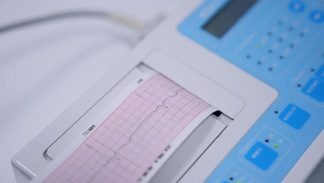 heart check up result produced by electrocardiograph. close up. medical equipment working in hospital.