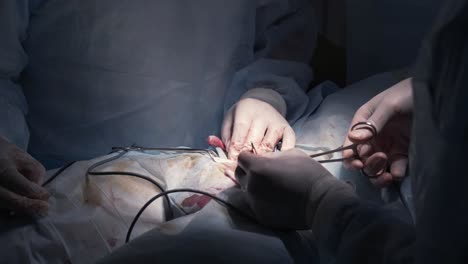 surgical procedure