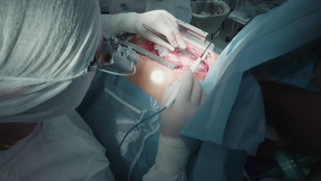 surgeon removes blood from wound with beating heart closeup. cardiologist doctor with laser tool during coronary artery bypass surgery in specialized hospital