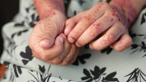 manos con diseños de henna y marcas