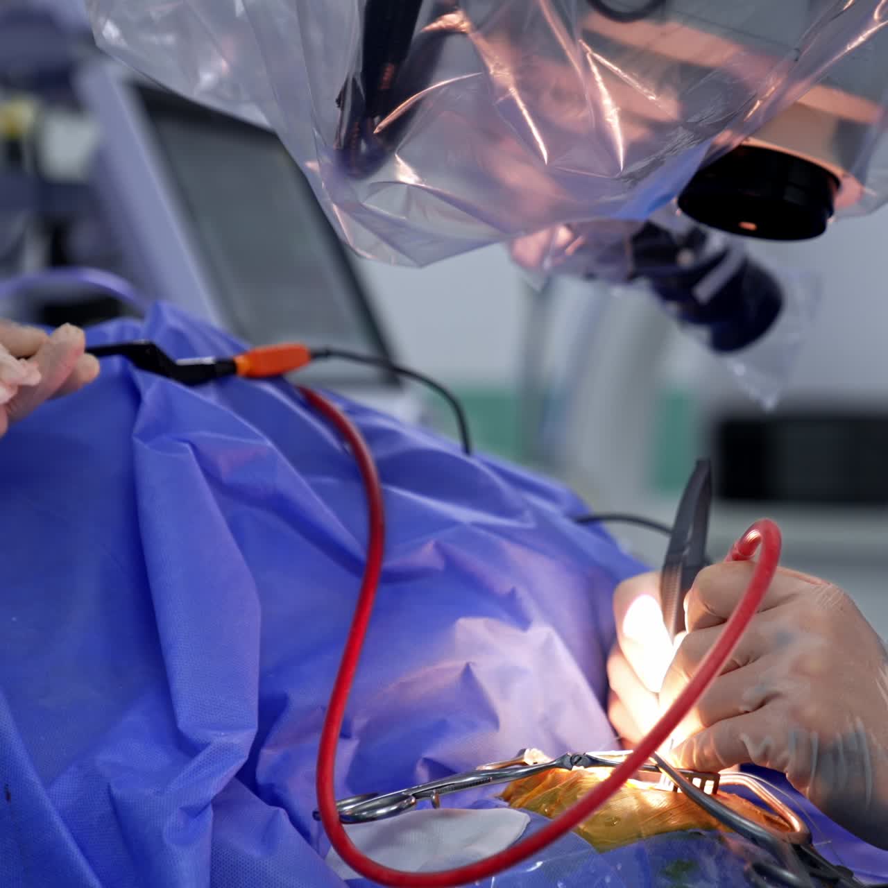 Hands of the doctor applying medical tools with tube. Assistants holding instruments ready for the surgeon. Microscope covered with plastic is over the patient
