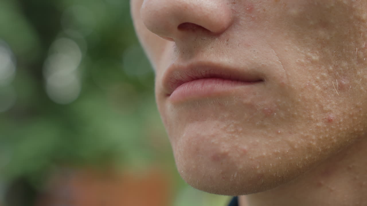 primo piano all'aperto di un uomo caucasico che sorride in modo accennato con una leggera espressione che si evolve da neutra a un sorriso, texture dell'acne e pori visibili, luce solare naturale, sfondo di un parco, giovane attore che passa da un atteggiamento riservato