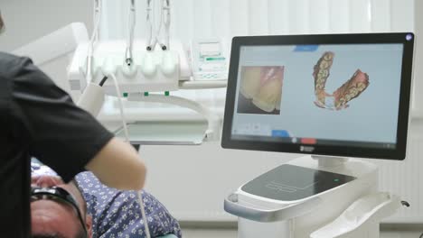 doctor scans the patient's teeth in the clinic. the dentist holds in his hand a manual 3d scanner for the jaw and mouth. dental health. creates a 3d model of teeth and gums on a medical monitor.