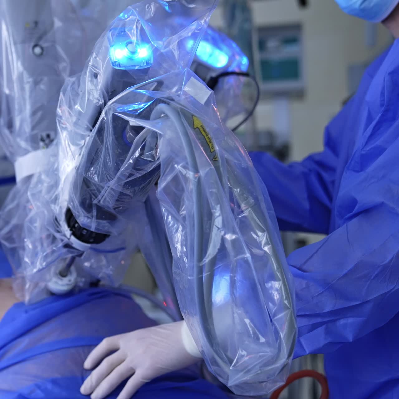 Robotic arms inserted in abdomen of a patient move slowly at surgery. Unrecognized medic stands near holding his hand on the patient