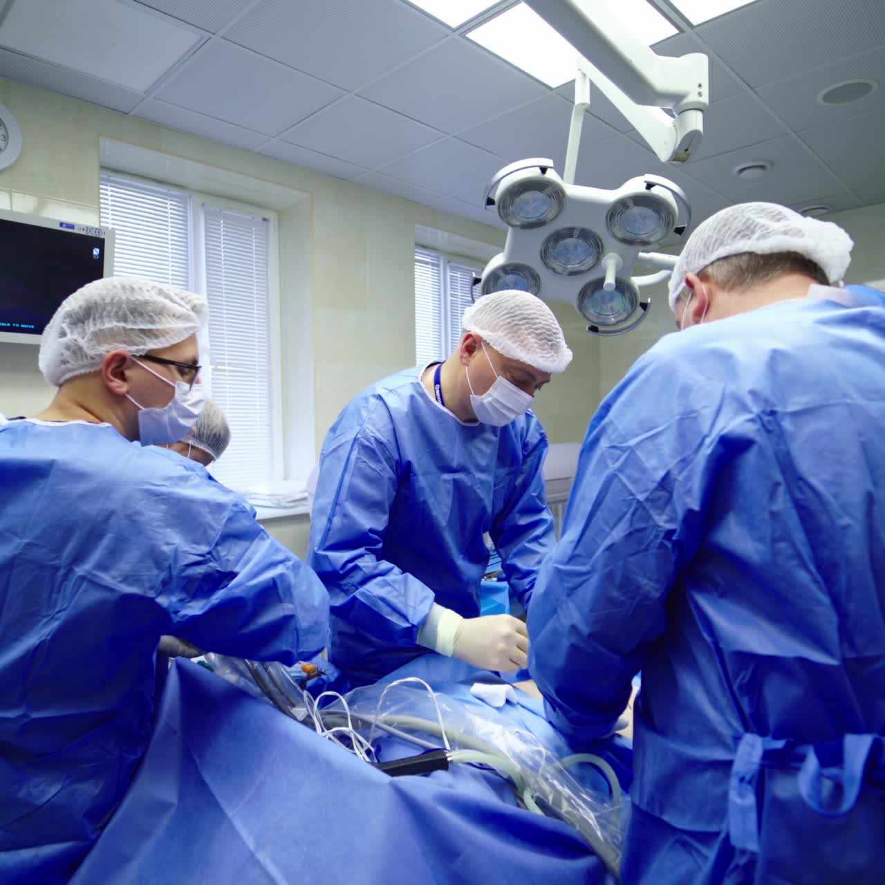Team surgeon at work in operating room. Modern equipment in operating room. Surgical system da Vinci