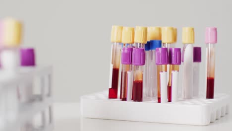 Video-of-close-up-of-test-tubes-on-white-background