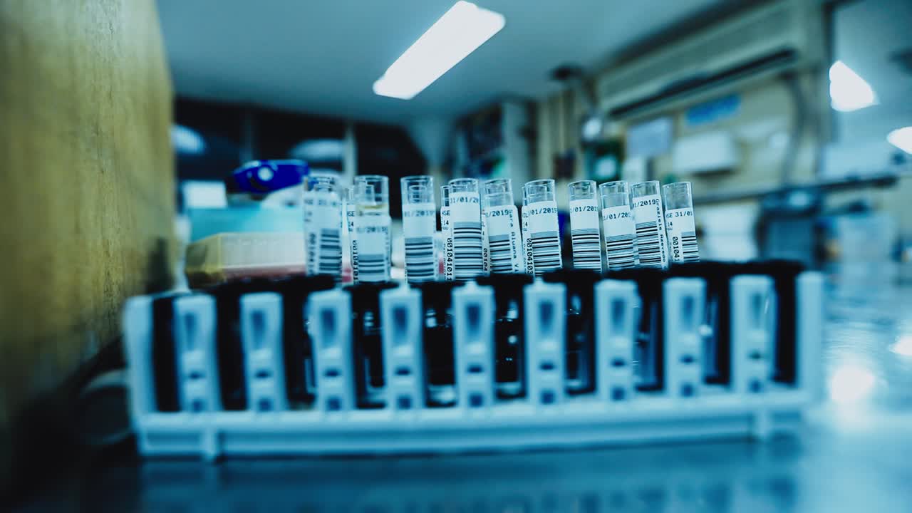 분석할 준비가 된 의료 실험실의 테스트 튜브 - 정적 격리 보기