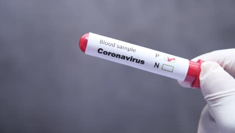 coronavirus blood sample test