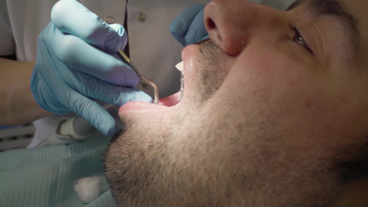 A male patient is having his tooth filled by a dentis woman.