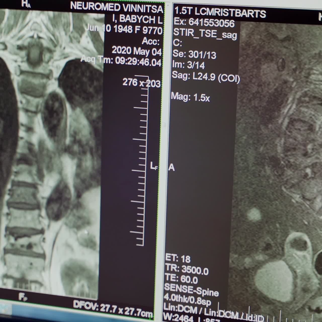 X-ray image of human