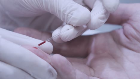 doctor hand taking blood sample for medical test. finger blood test