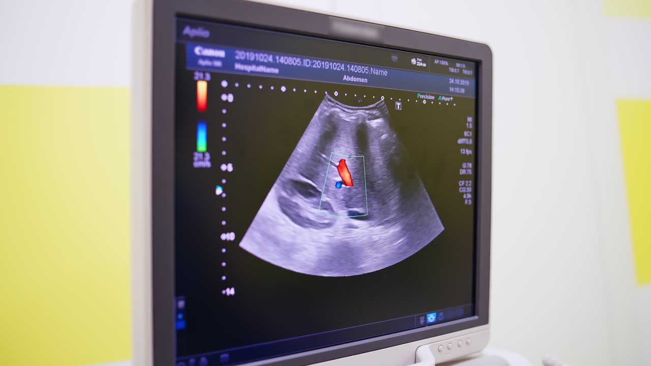 Medical sonography scan. Ultrasound machine in modern operating laboratory