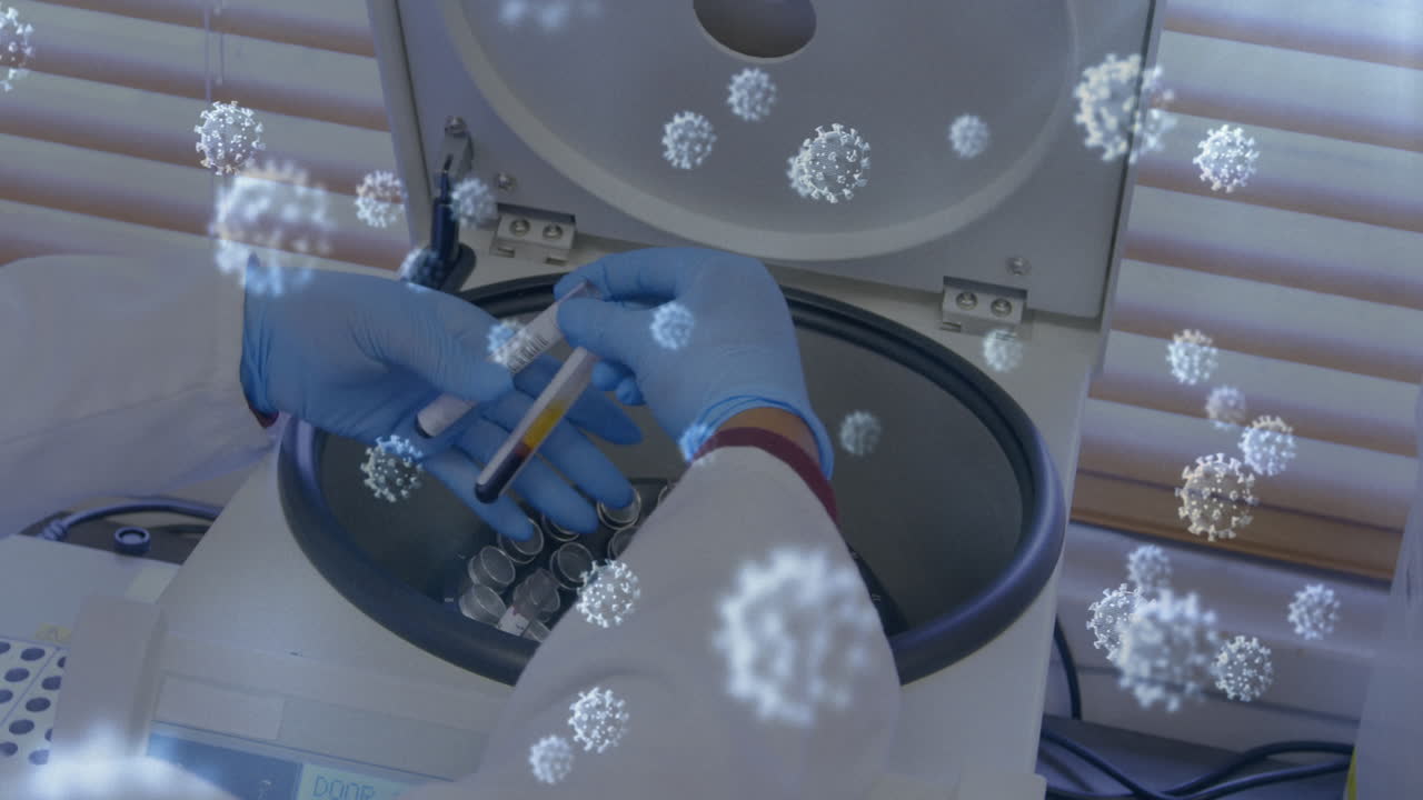 표본을 가져가는 여성 의사 위에 떠다니는 거대 코로나19 세포의 애니메이션