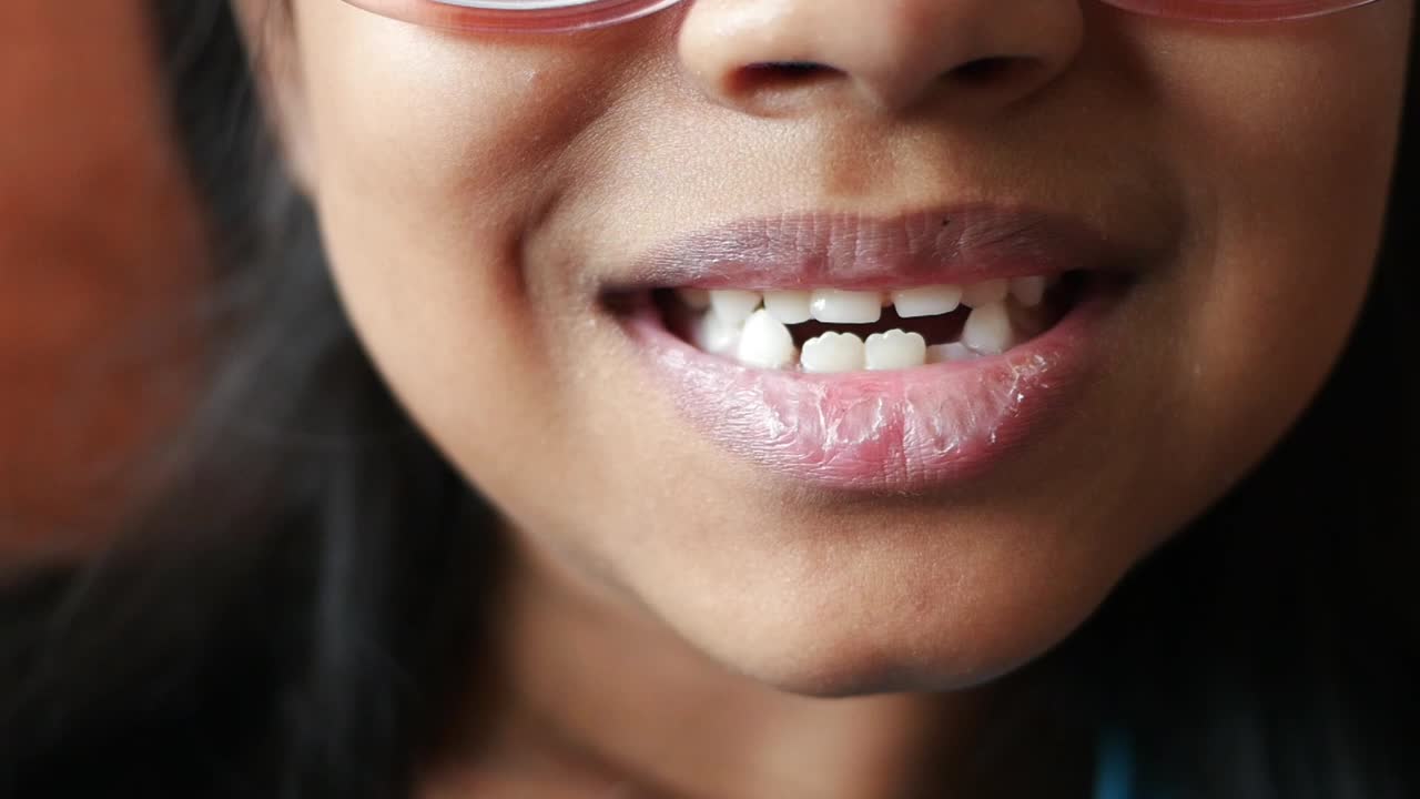 primer plano de una joven sonriendo con sus dientes mostrando