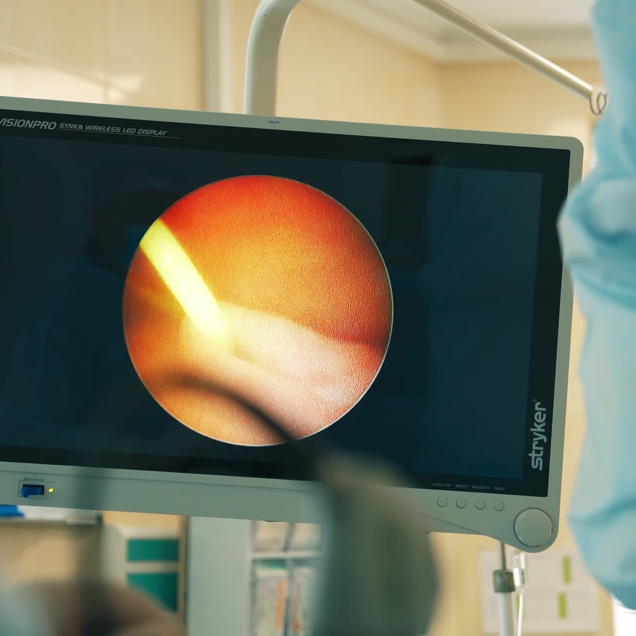 Enlarged sight of operated organ shown at the screen in operational theatre. Doctor moves the tool at foreground in blur