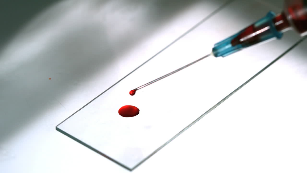 Blood dropping from syringe onto slide