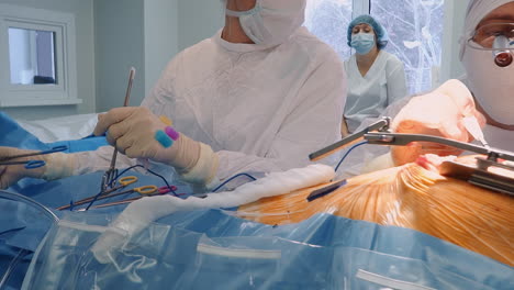 surgeon with assistant conducts heart surgery. doctor with binoculars and nurse work together during complicated coronary artery bypass surgery in hospital