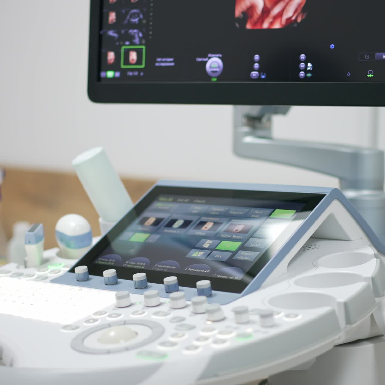 Black monitor with a prenatal picture of unborn baby. Ultrasound diagnostic for pregnant woman on modern equipment