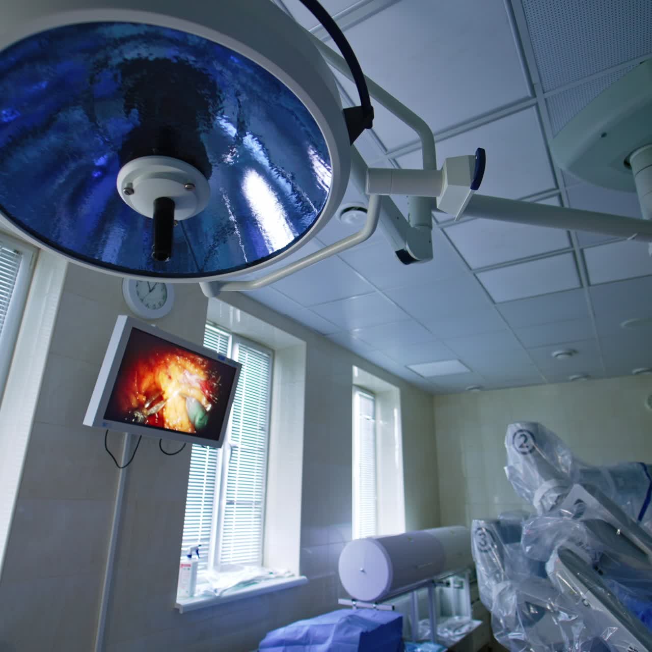 Metal forceps work with the live tissue on the monitor hanging on the wall. Screen showing the pwork of Da Vinci surgeon's manipulators