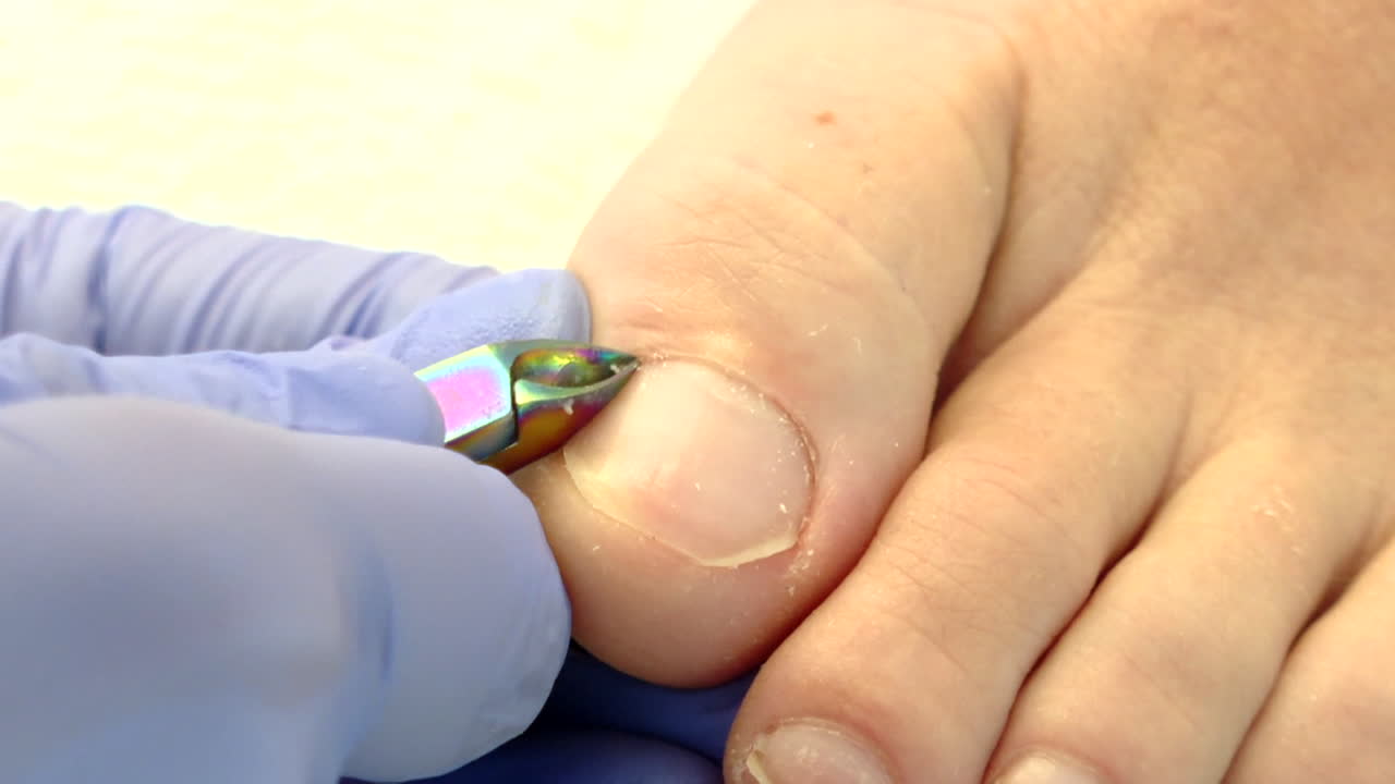 Toenail care by a professional