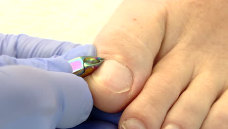 toenail care by a professional