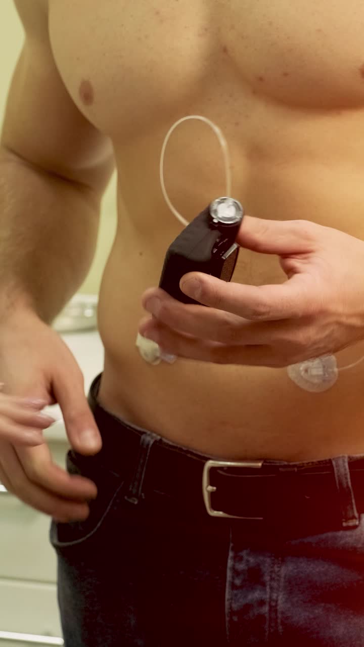 Medical Professional Connecting Insulin Pump to Patient's Abdomen