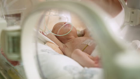 feeding a premature baby in nicu