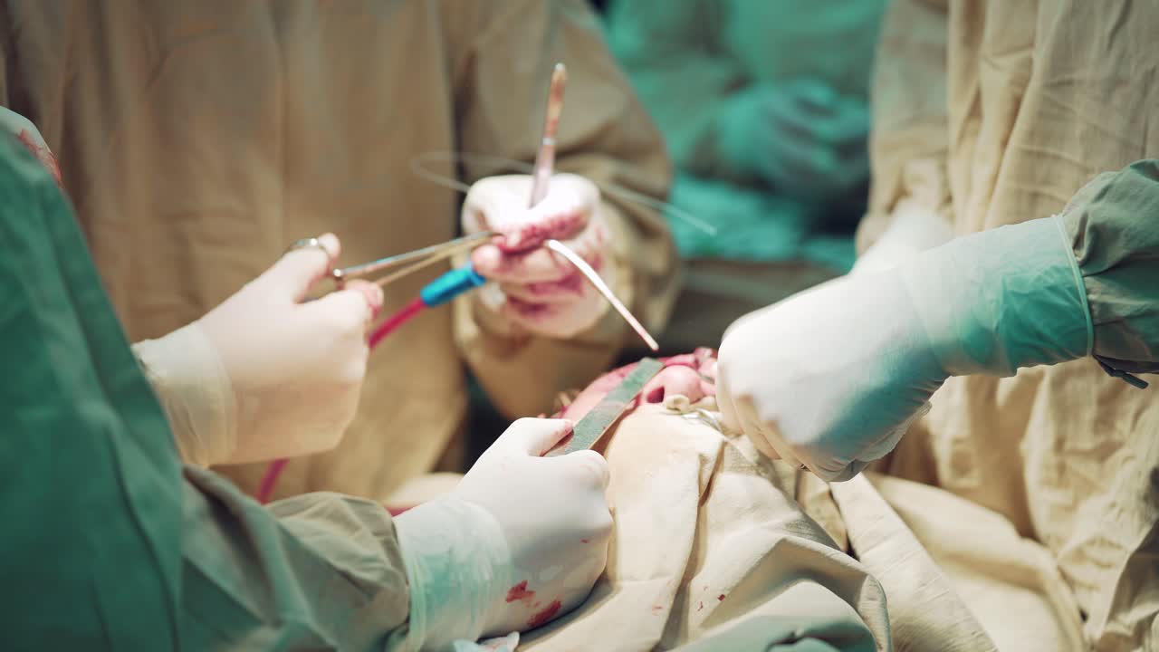 Close-up of a surgeon's hands performing a surgical procedure using sterilized equipment. Surgery and emergency concept