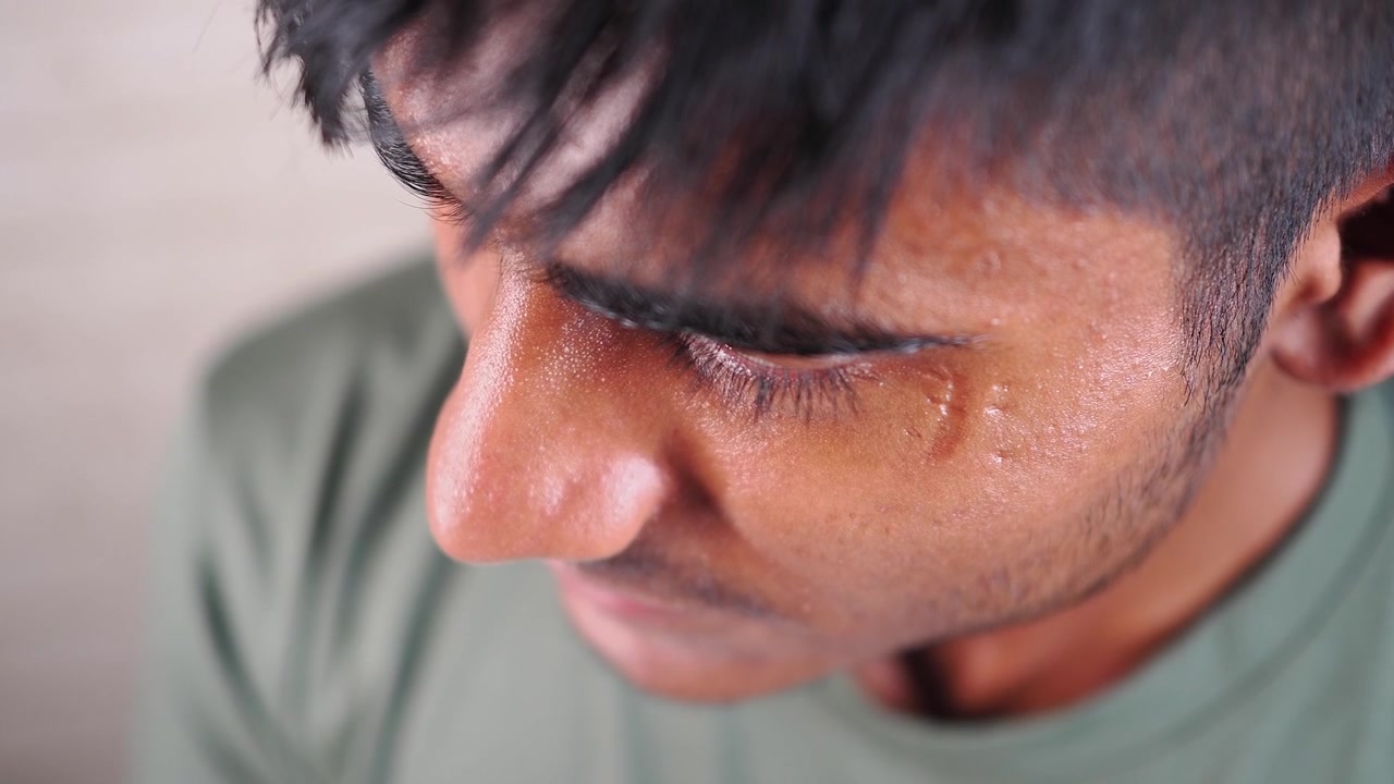 Close-up of a Young Man's Face with a Scar