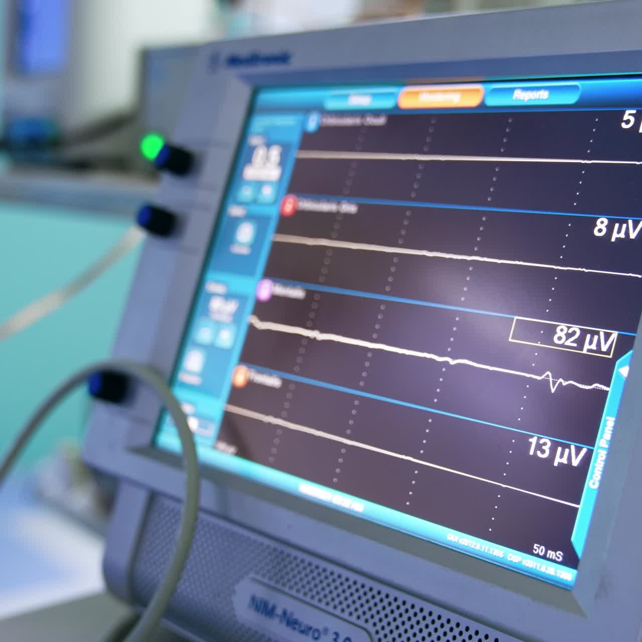Schermo del sistema di neuromonitoraggio intraoperatorio acceso. Attrezzatura in funzione in sala operatoria durante la neurochirurgia.