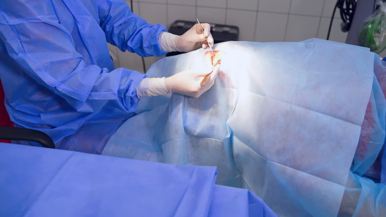 Medical worker performing eye surgery. Professional ophthalmologist performs eye surgery with medical equipment